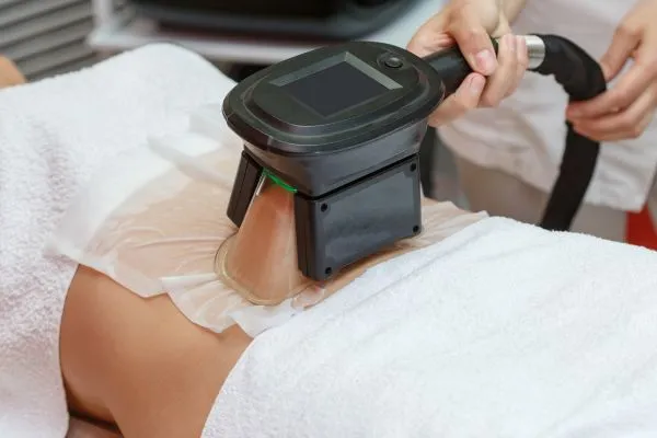 Image of person having fat freezing treatment to help weight gain Highworth