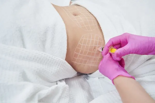 image of fat dissolving injections on love handles to help combat weight gain Highworth