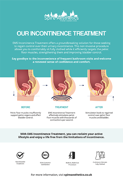 image to show how EMS treatment works for female urinary incontinence Highworth