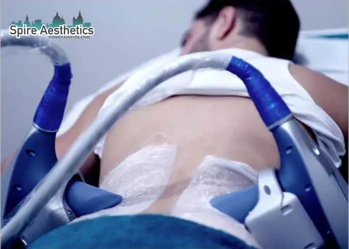 Man having fat freezing treatment done on love handles before a competitions Highworth to create a sculpted look.