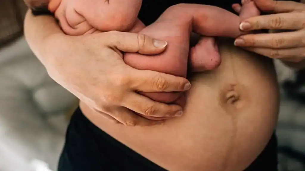 Why Is My Stomach Still Big After Pregnancy Highworth?
