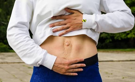 When Could Diastasis Recti Be the Missing Piece of the Puzzle Highworth?
